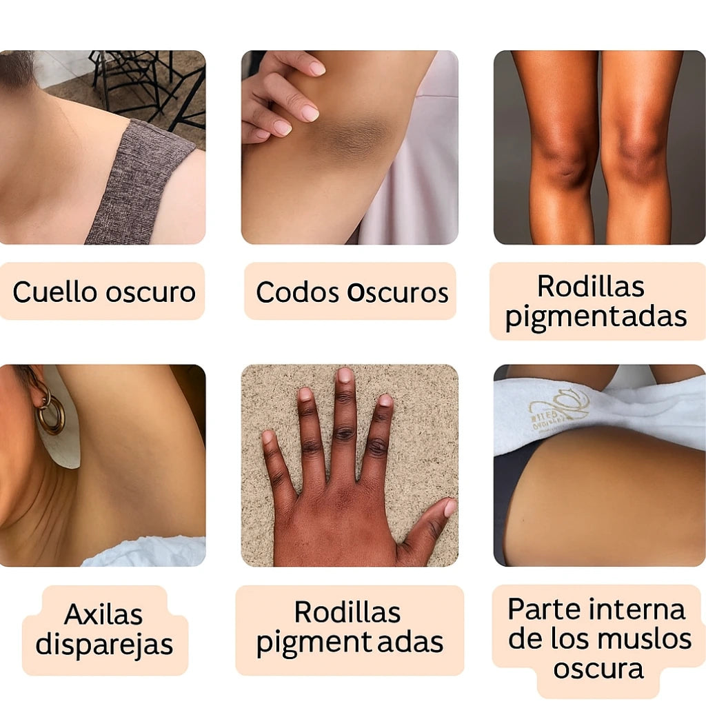 Dr Melaxin™: Tratamiento despigmentante a base de Cúrcuma en Gel