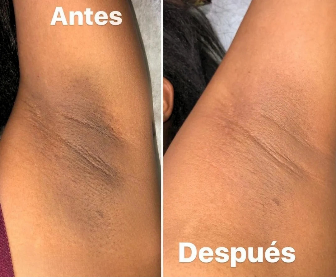 Dr Melaxin™: Tratamiento despigmentante a base de Cúrcuma en Gel